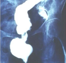 PRINCÍPIOS DE COLOPROCTOLOGIA