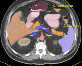 PRINCÍPIOS DE CIRURGIA